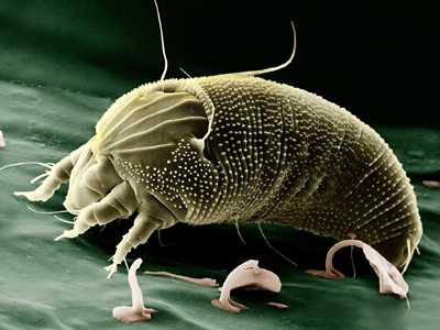 How-a-Filthy-HVAC-System-Affects-Your-Health_